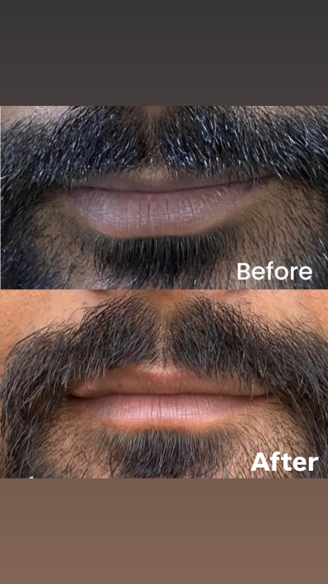 Before and after treatment comparison